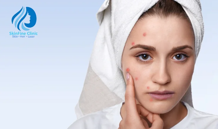 Dark Spots